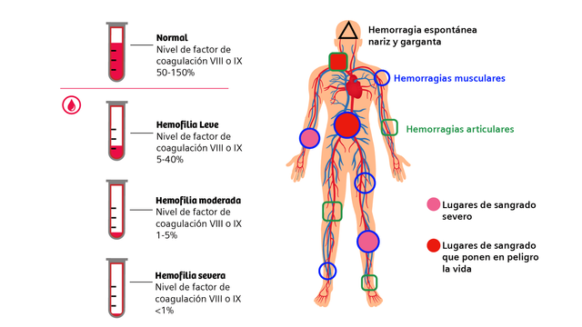 Severidad-y-sintomas-ES.png