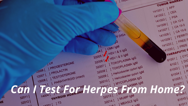 Can I Test For Herpes From Home.png