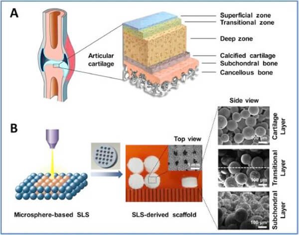 Natural osteochondral repair.jpg