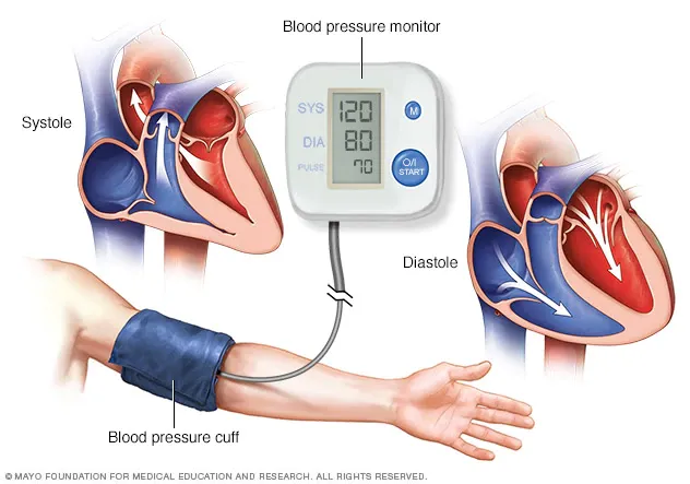 blood-pressure-monitor-8col-3559308-001-0.jpg