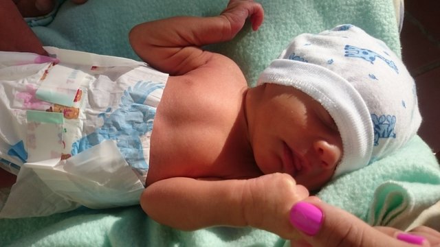 Banos De Sol En Recien Nacidos Steemit Banos De Sol En Recien Nacidos Steemit