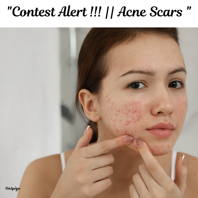 Brown Illustration Acne Scars Cheat Sheet Instagram Post.png