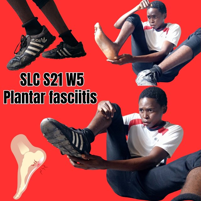 Plantar fasciitis_20241128_191252_0000.jpg