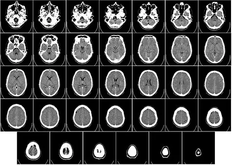 computer-tomography-62942__340.webp