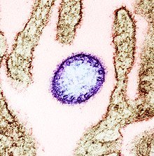 220px-Nipah_virus_from_an_infected_VERO_cell.jpg