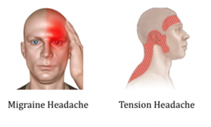 headache-treatment-types-300x180.png