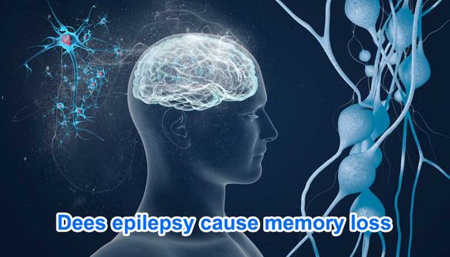 neeraj epilepsy clinic 77.jpg