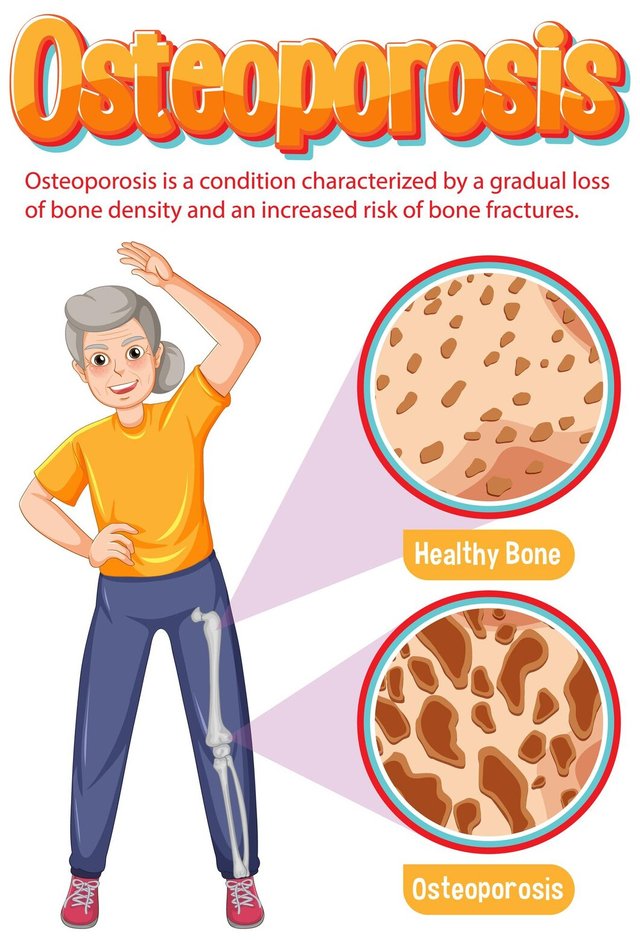 comparison-normal-bone-bone-with-osteoporosis-old-peop_1308-131671.jpg