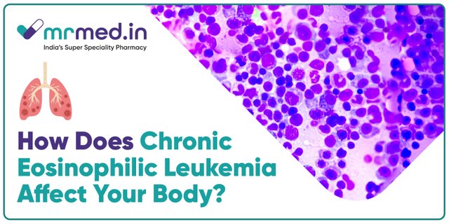How Does Chronic Eosinophilic Leukemia Affect Your Body.jpg