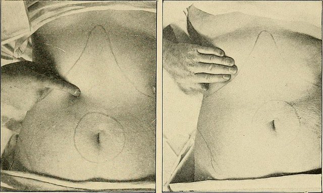 The_diagnosis_and_treatment_of_diseases_of_women_(1907)_(14761452386).jpg