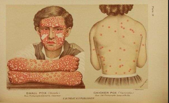 Cowpox And Smallpox.png