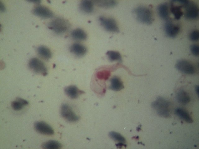 Trypanosoma vivax..JPG