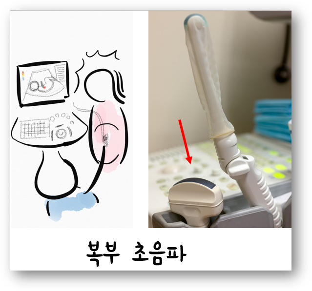 복부 초음파.png