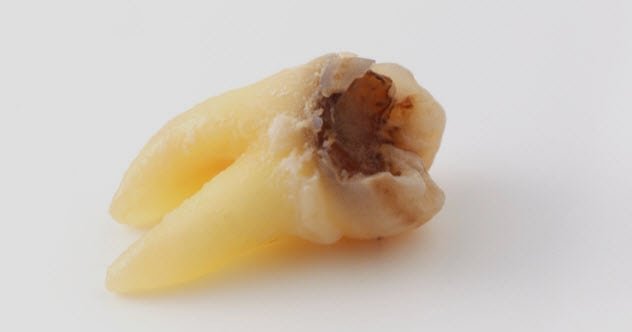 7b-tooth-182151791.jpg