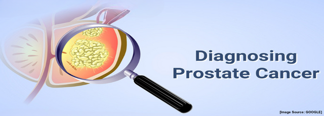 Diagnosis of Prostate Cancer.png