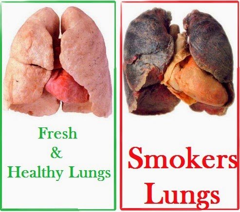 long-effects-of-smoking-respiratory-System.jpg
