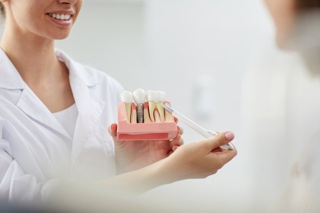 5 Compelling Reasons to Choose Dental Implants for Missing Teeth.jpg