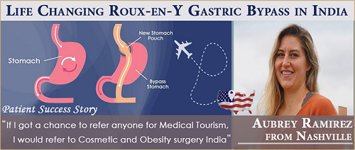 USA Patient Finally Gets Better Quality Life After Roux-en-Y Gastric Bypass in India.png