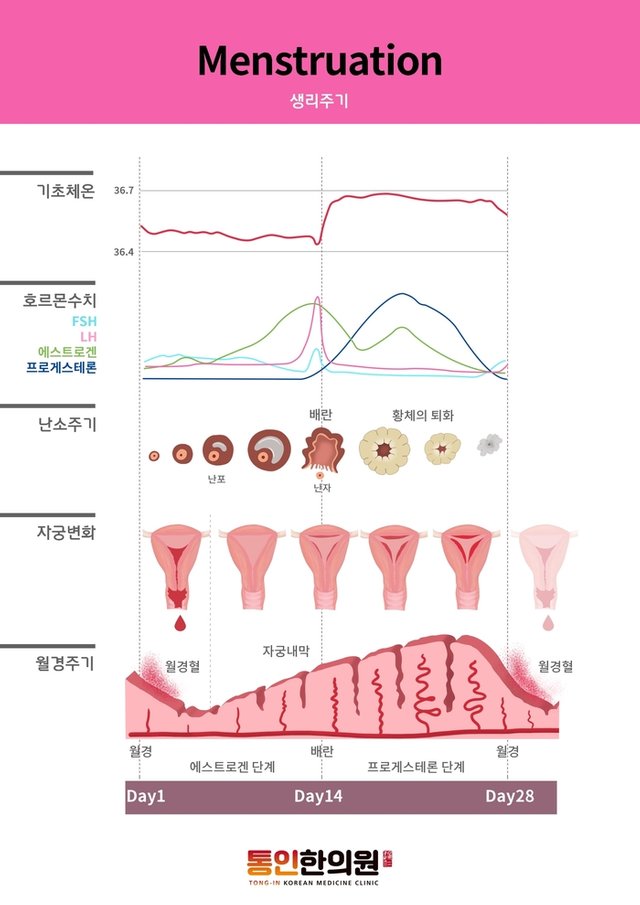 생리주기 통인한의원 생리통한약.jpg