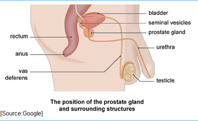 Addressing the Global Prostate Problem A Comprehensive Solution.png