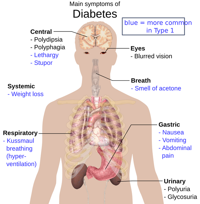 2000px-Main_symptoms_of_diabetes.svg.png