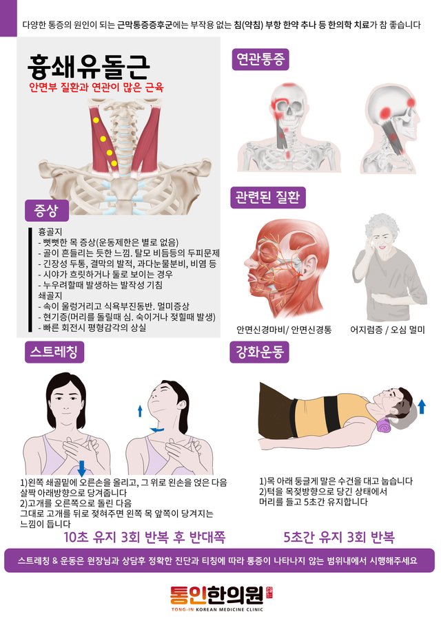 14)[근육처방전]흉쇄유돌근.jpg