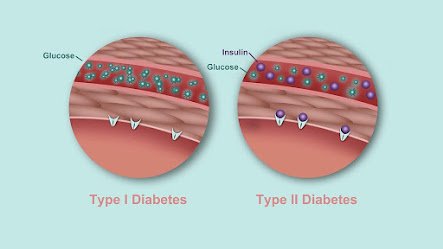 whats-the-difference-between-type-1-and-type-2-diabetes-rm-1440x810.jpg