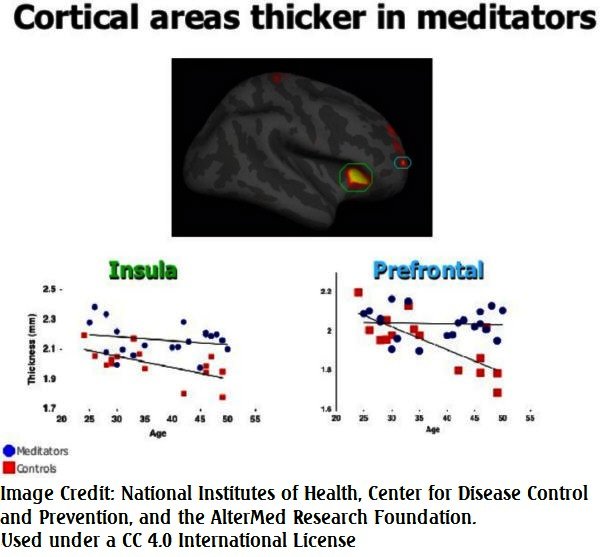 Cortical_Areas_Thicker_in_Meditators_National Institutes of Health, the Center for Disease Control and Prevention, and the AlterMed Research Foundation 4.0.jpg