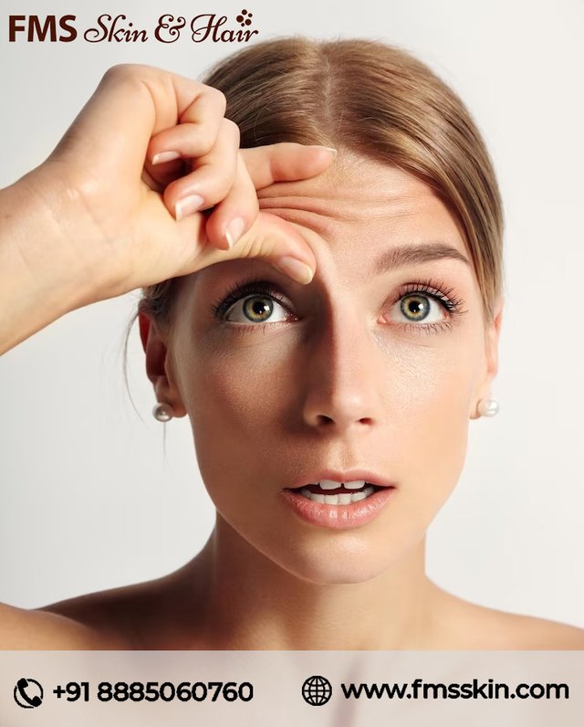 Anti Wrinkles Treatment.jpg