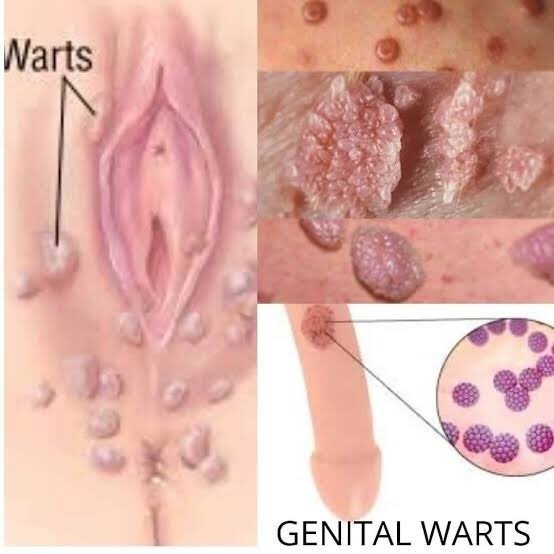 genitals.jpg