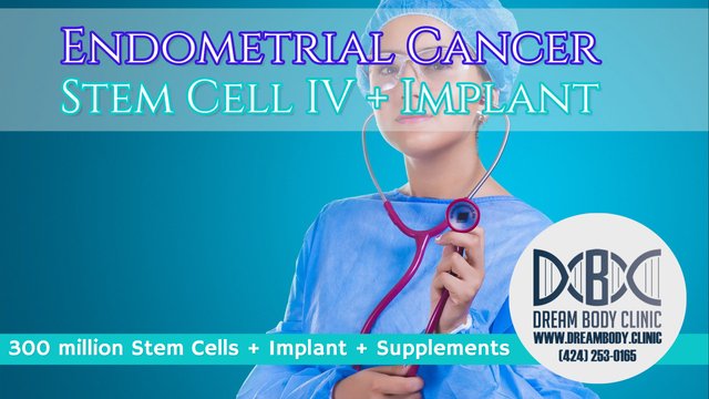endometrial cancer stem cell treatment dreambody clinic youtube.jpg