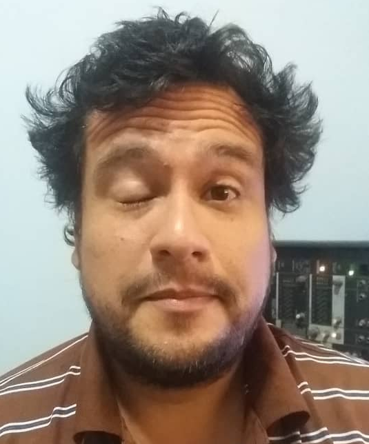 pelo frente y ojo.png