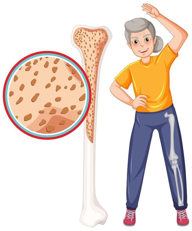 osteoporosis-old-people_1308-131425.jpg