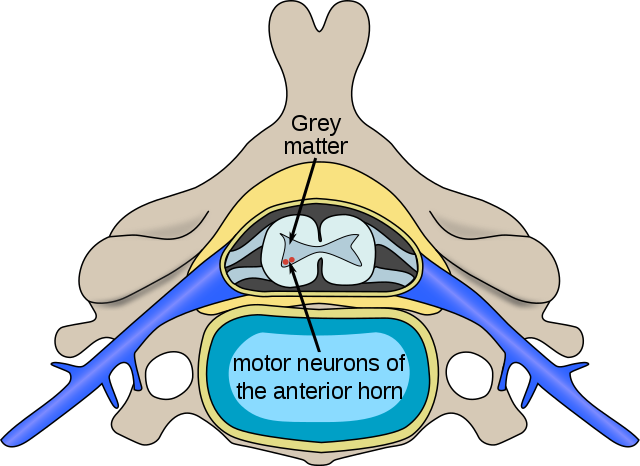 640px-Polio_spinal_diagram-en.svg.png