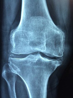 knee-1406964__340.jpg