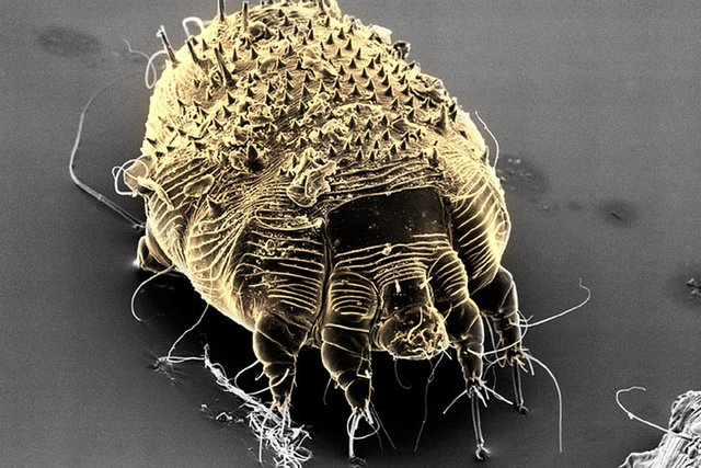 1800ss_photolibrary_rf_photo_of_scabies_mite.jpg