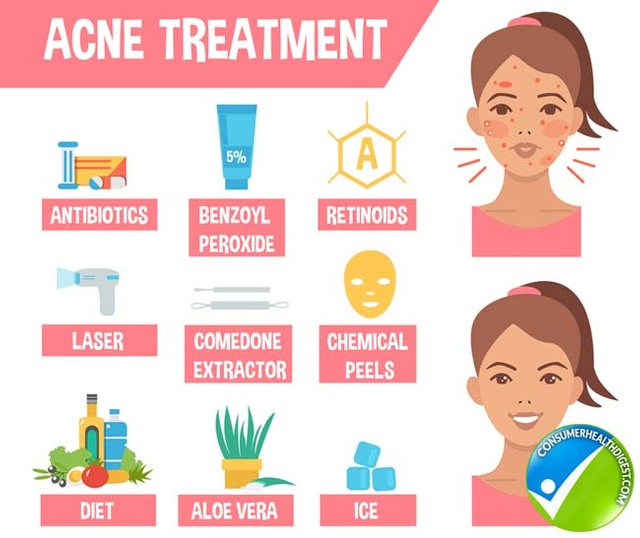 acne-treatment-detail.jpg