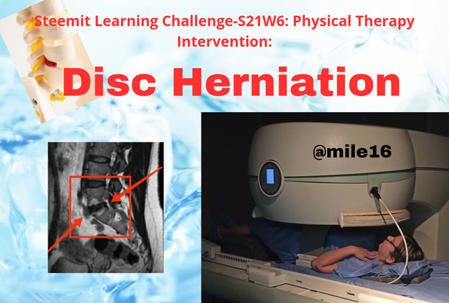 Steemit Learning Challenge-S21W6_ Physical Therapy Intervention__20241205_123749_0000.png