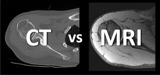 ct mri.jpg