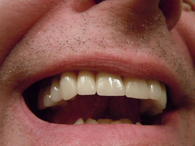 teeth-414489_1280.jpg