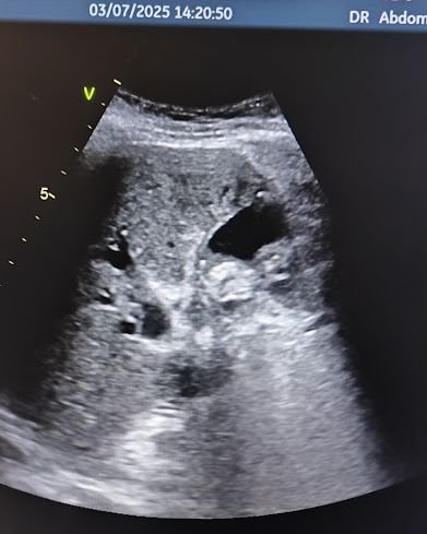 Ultraschall.jpg