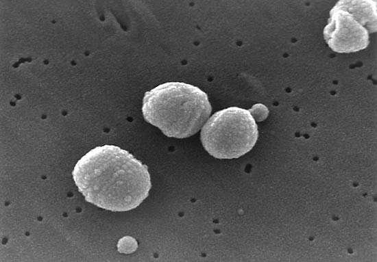 Scanning-electron-micrograph-Streptococcus-pneumoniae.jpg