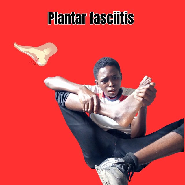 Plantar fasciitis_20241128_191253_0004.jpg