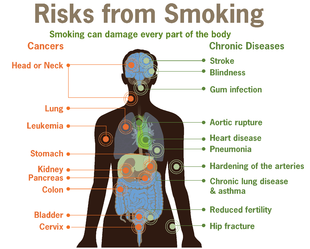 310px-Risks_form_smoking-smoking_can_damage_every_part_of_the_body.png