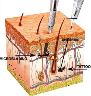 DERMIS Y EPIDERMIS2.jpg