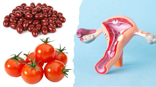 Tomatoes and Lycopene may Help Reduce Fibroids.jpg