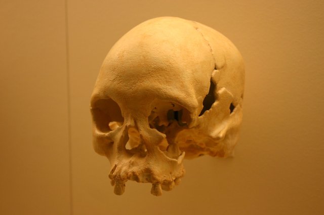 Lapa_Vermelha_IV_Hominid_1-Homo_Sapiens_11,500_Years_Old.jpg