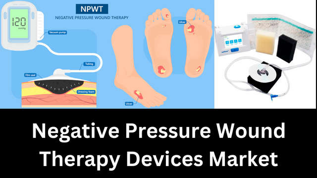 Negative Pressure Wound Therapy Devices Market C.png