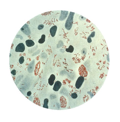 240px-Mycobacterium_leprae.jpeg