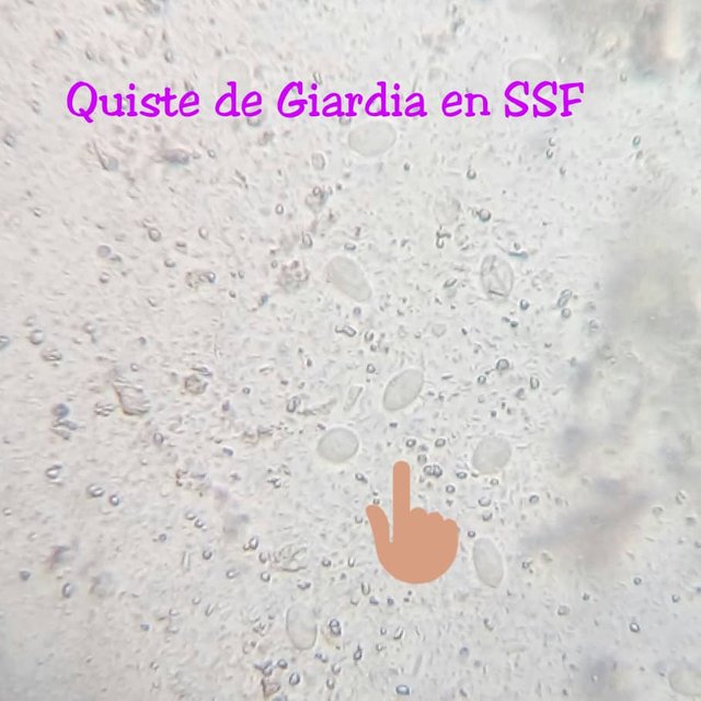 quistes de giardia en heces